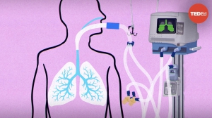 Как работают аппараты искусственной вентиляции лёгких (ИВЛ)? 